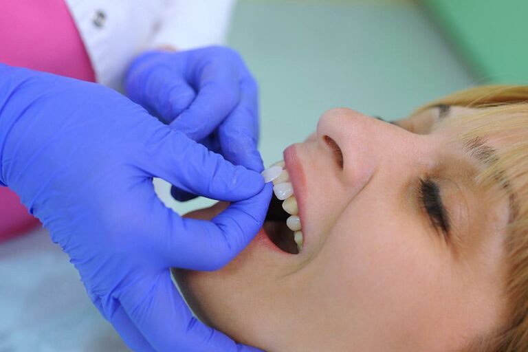 veneers.17.626d477f74513